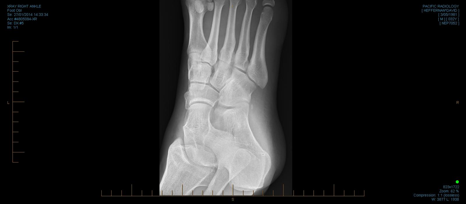 xray