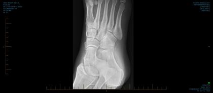 xray
